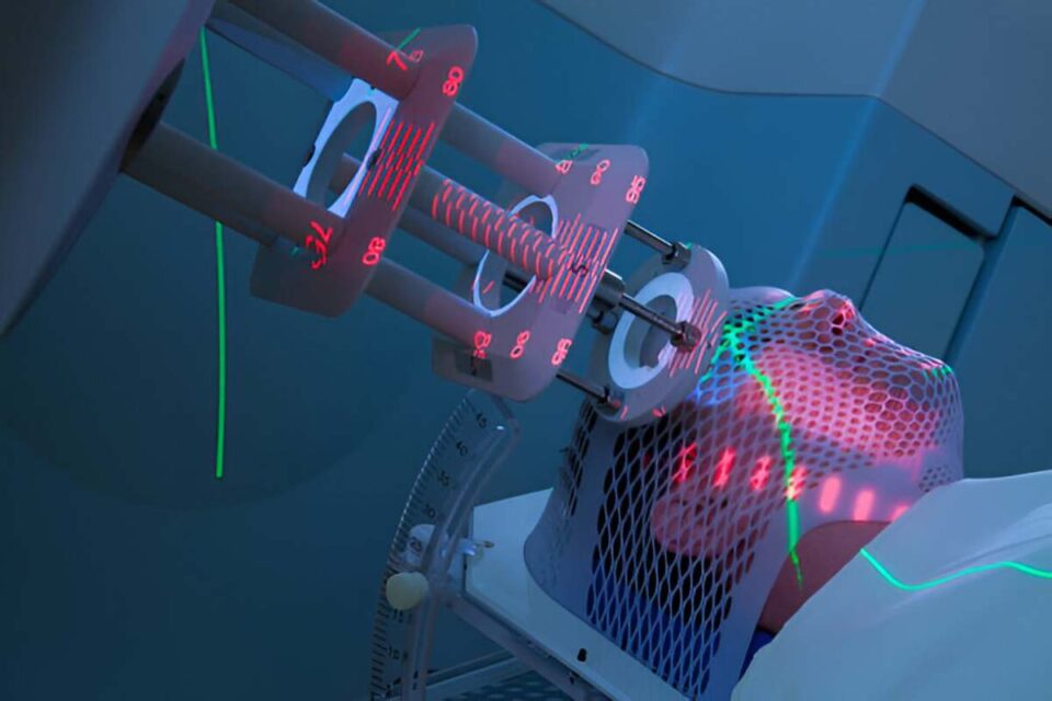 Laser Technology