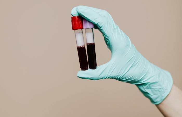 blood test for mold exposure