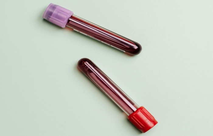 limitations of mold blood testing